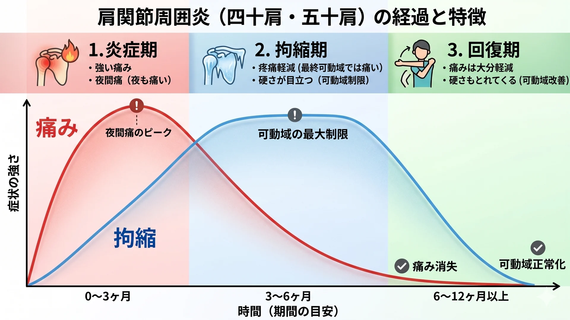 `大阪のSTRUCT Conditioningが解説する四十肩五十肩の改善アプローチ